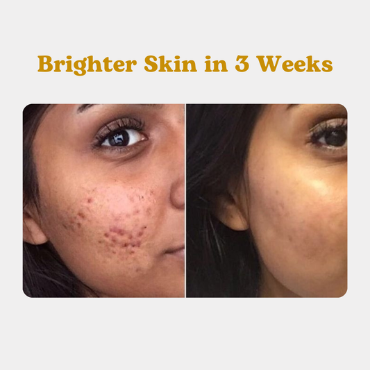 Golden Glow Face Pack